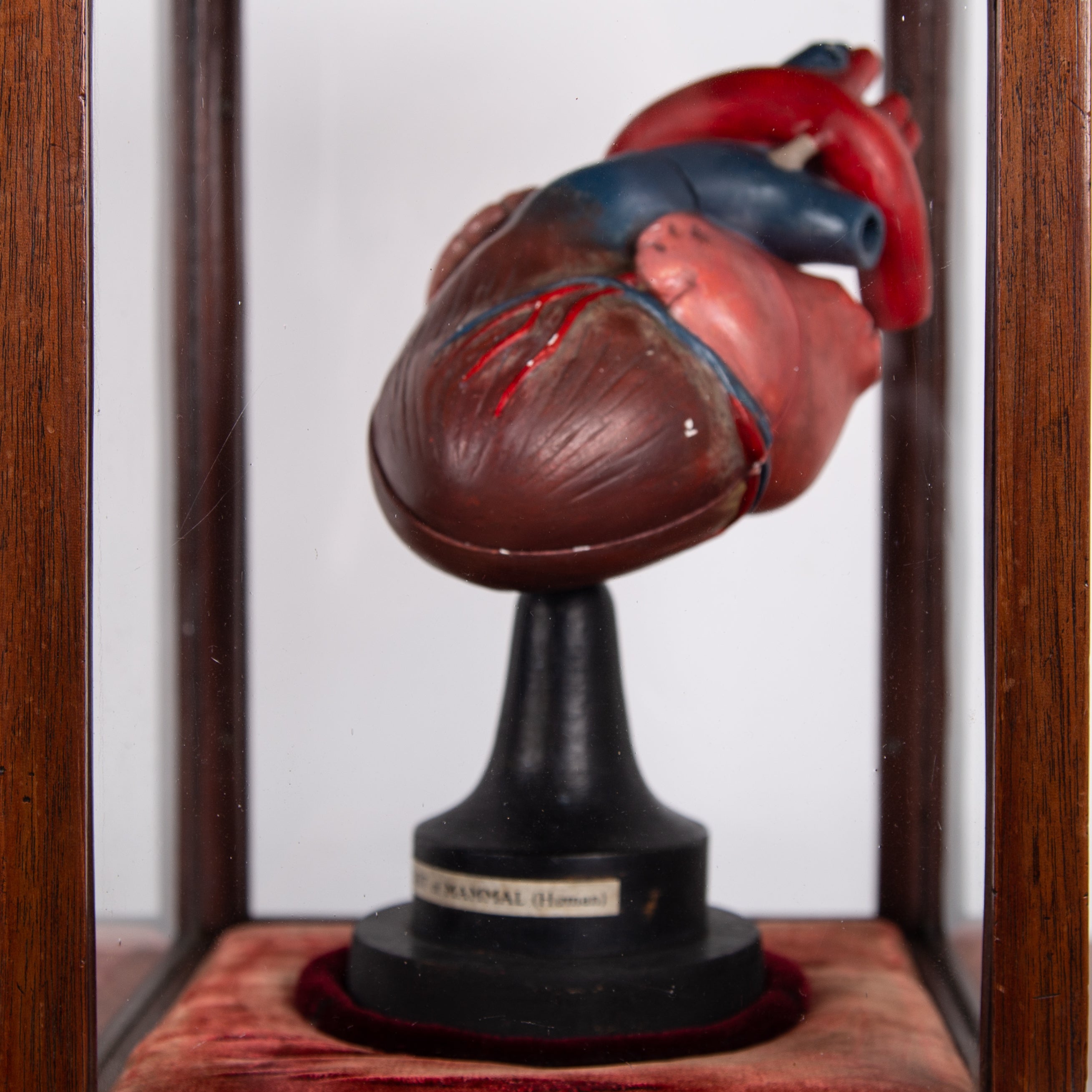 Anatomical Heart In Fine Display Case Cabinet